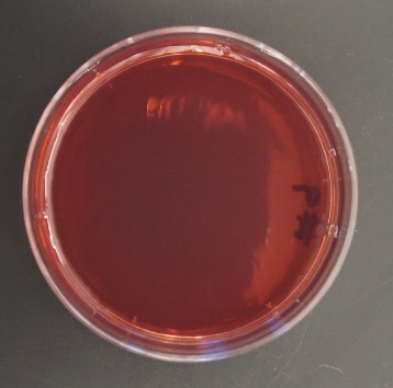 MacConkey’s Agar.