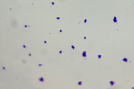 Gram Stain.