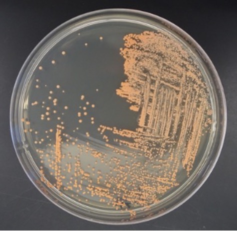 Nutrient Agar.