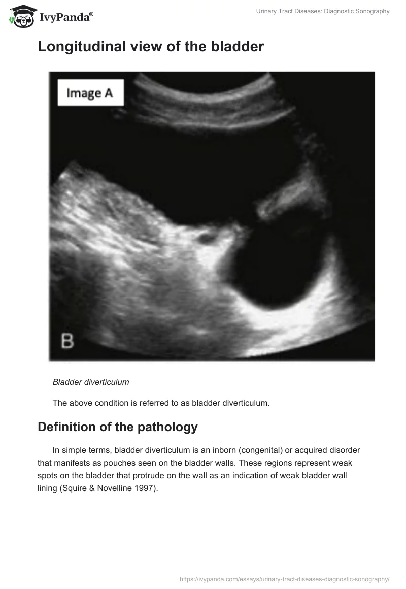 Urinary Tract Diseases: Diagnostic Sonography. Page 3