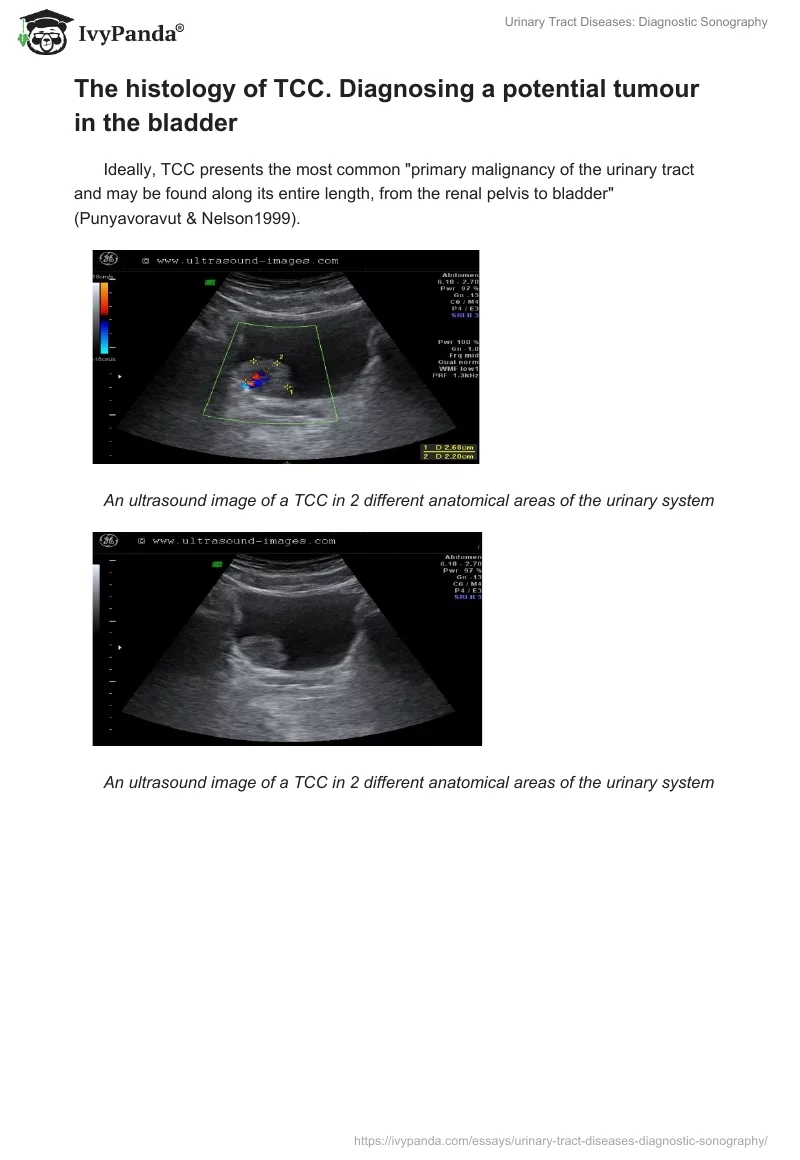 Urinary Tract Diseases: Diagnostic Sonography. Page 5