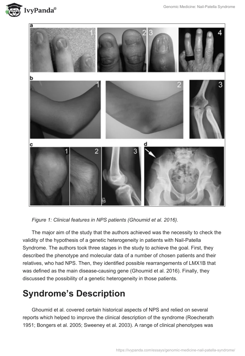 Genomic Medicine: Nail-Patella Syndrome. Page 2
