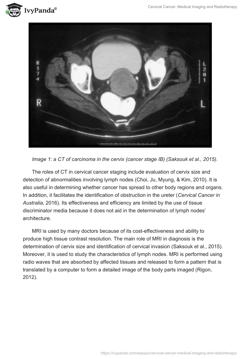 Cervical Cancer: Medical Imaging and Radiotherapy. Page 3
