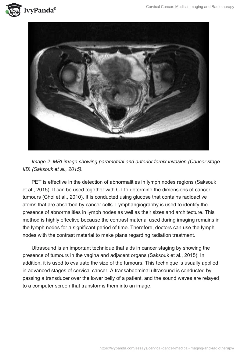 Cervical Cancer: Medical Imaging and Radiotherapy. Page 4