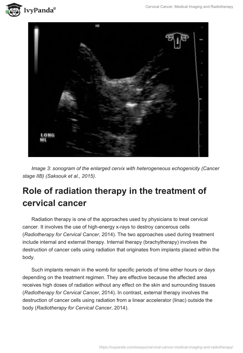 Cervical Cancer: Medical Imaging and Radiotherapy. Page 5