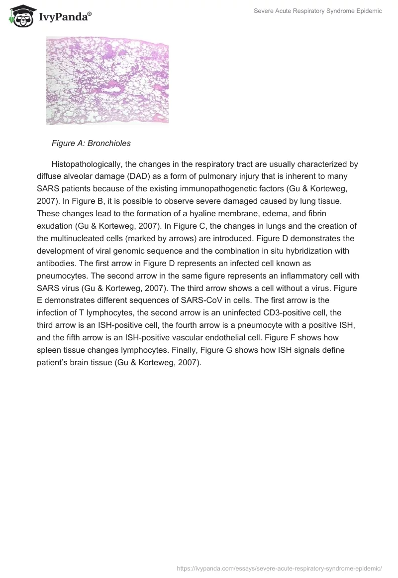 Severe Acute Respiratory Syndrome Epidemic. Page 4
