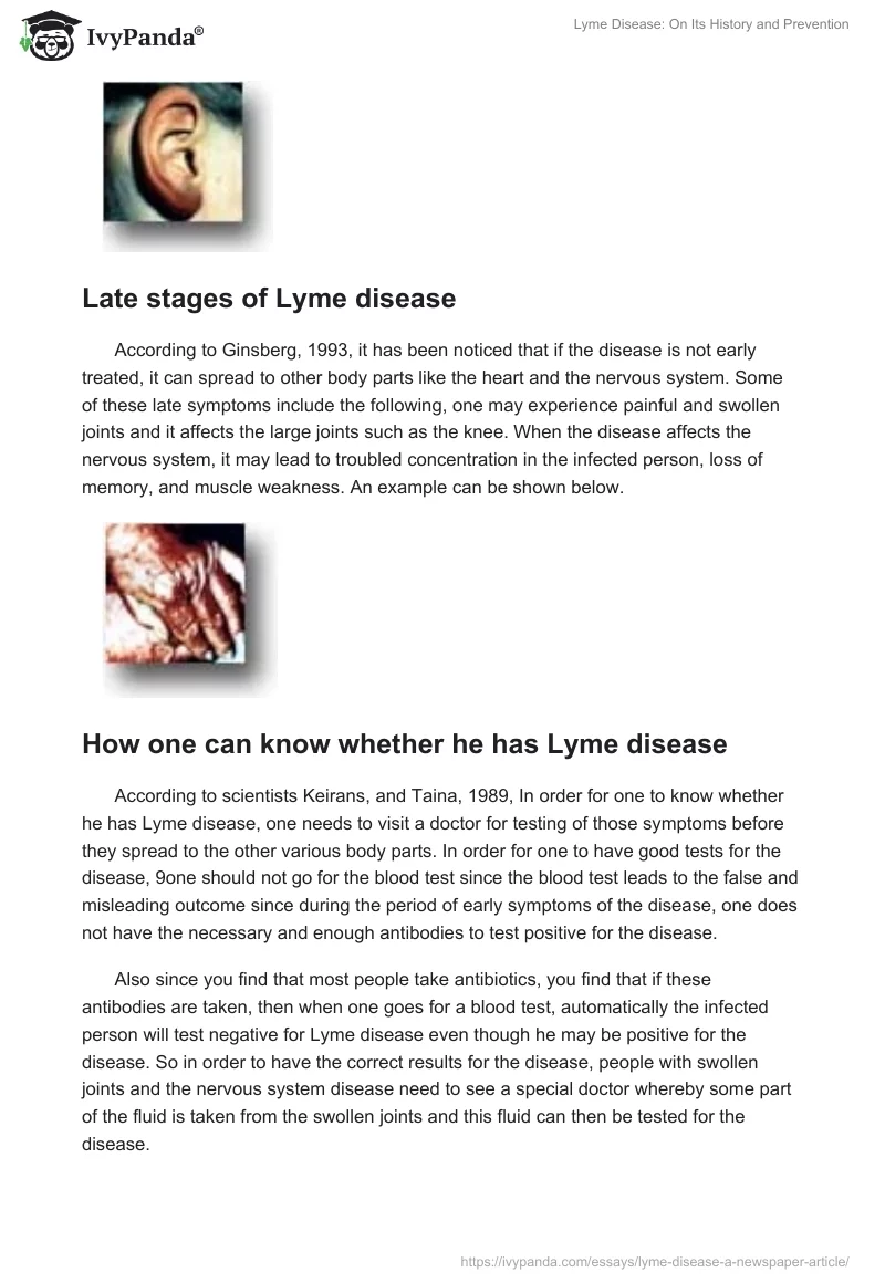 Lyme Disease: On Its History and Prevention. Page 3