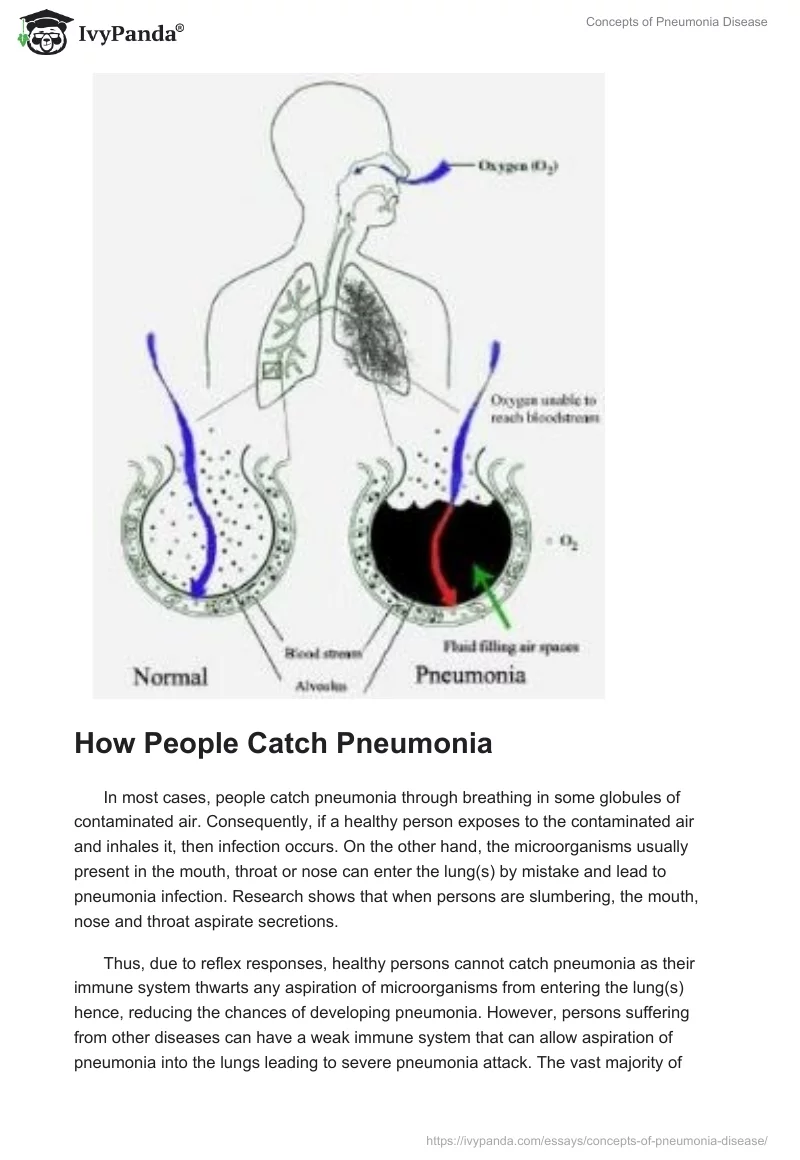 Concepts of Pneumonia Disease. Page 2