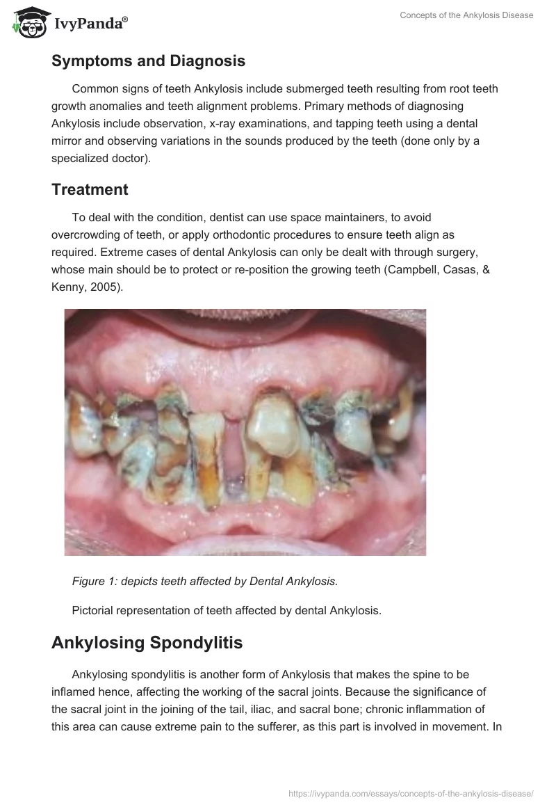 Concepts of the Ankylosis Disease. Page 2