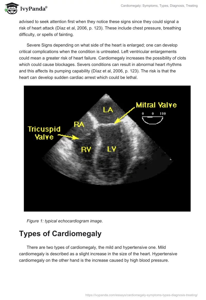 Cardiomegaly: Symptoms, Types, Diagnosis, Treating. Page 2
