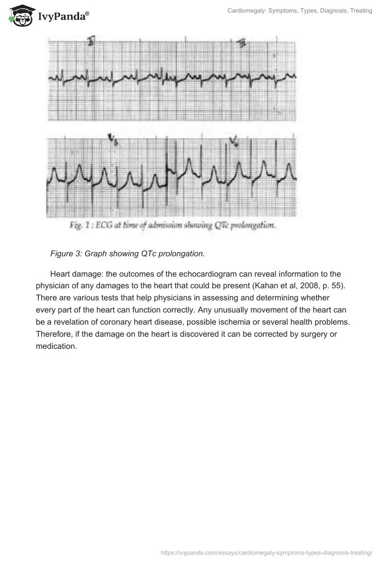 Cardiomegaly: Symptoms, Types, Diagnosis, Treating. Page 5
