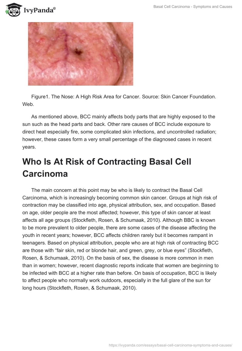 Basal Cell Carcinoma - Symptoms and Causes. Page 2