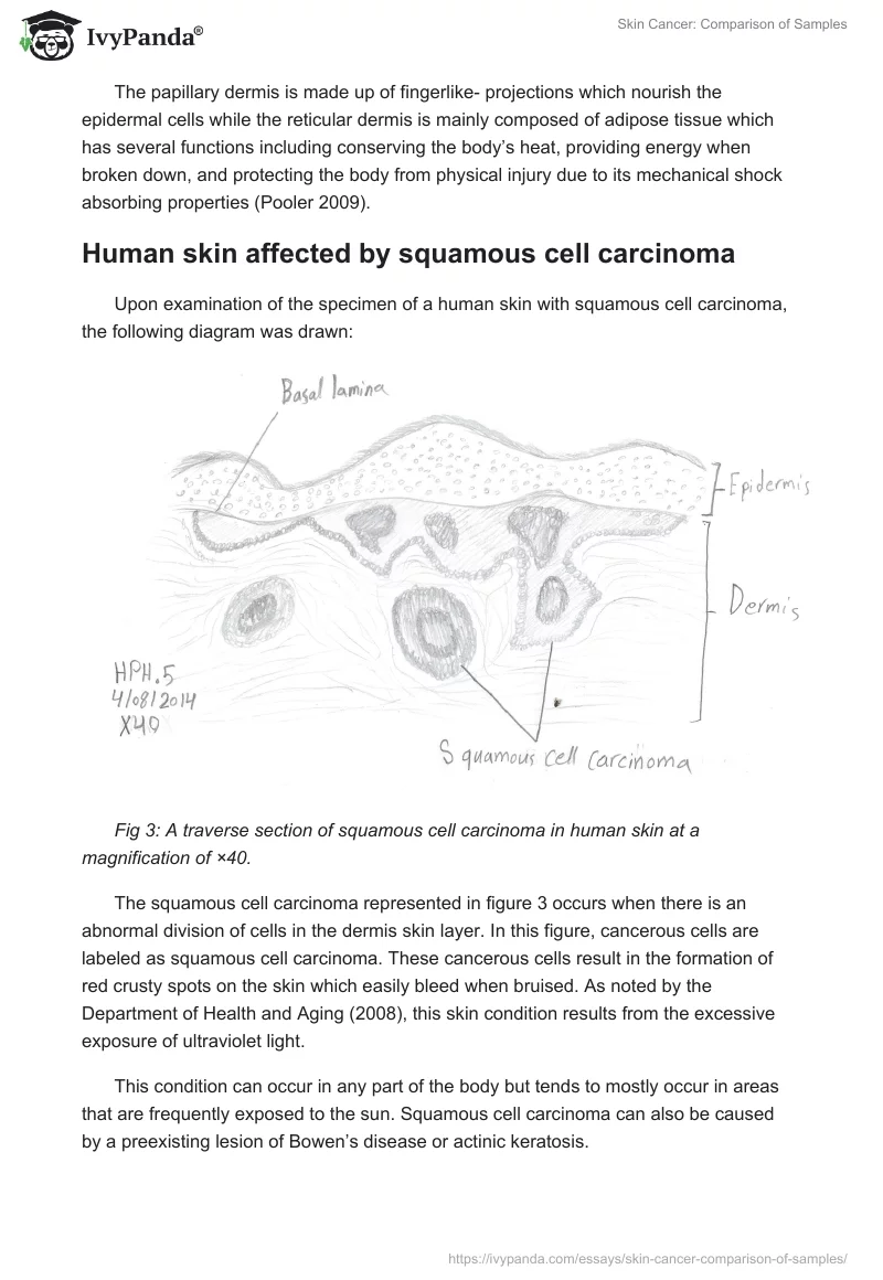 Skin Cancer: Comparison of Samples. Page 5
