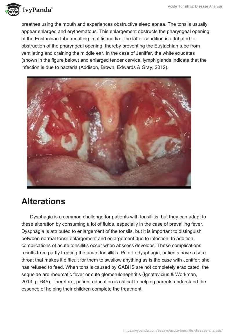 Acute Tonsillitis: Disease Analysis. Page 3