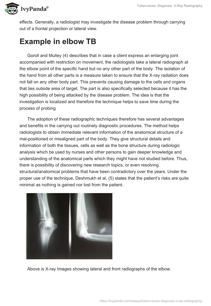 Tuberculosis: Diagnosis, X-Ray Radiography. Page 4