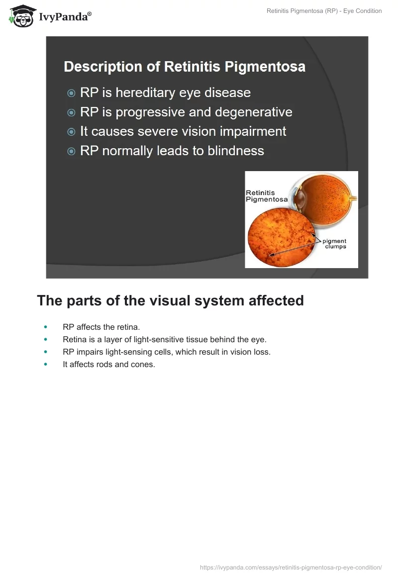 Retinitis Pigmentosa (RP) - Eye Condition. Page 2