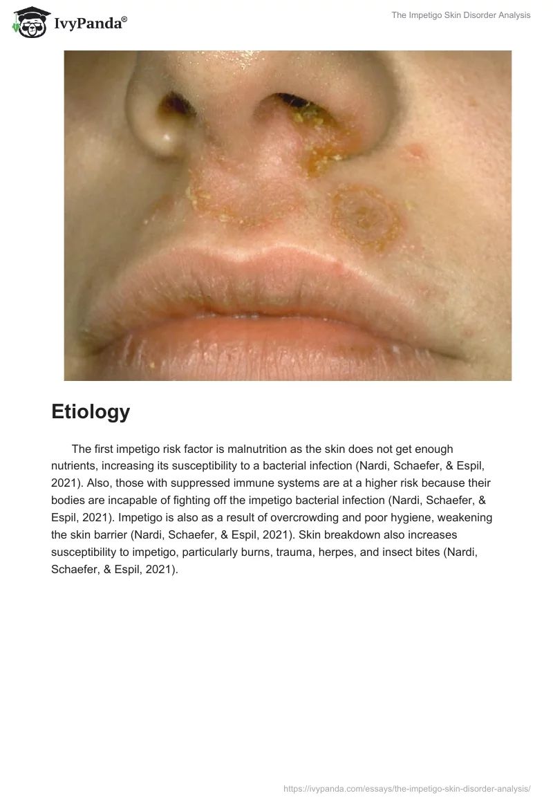 The Impetigo Skin Disorder Analysis. Page 2