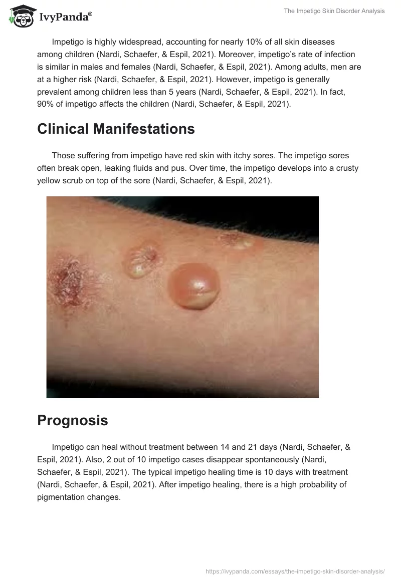 The Impetigo Skin Disorder Analysis. Page 4