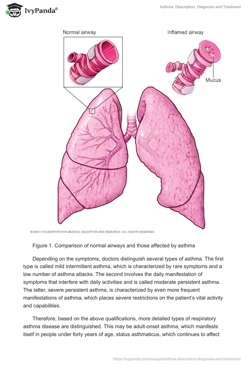 Asthma: Description, Diagnosis and Treatment. Page 2