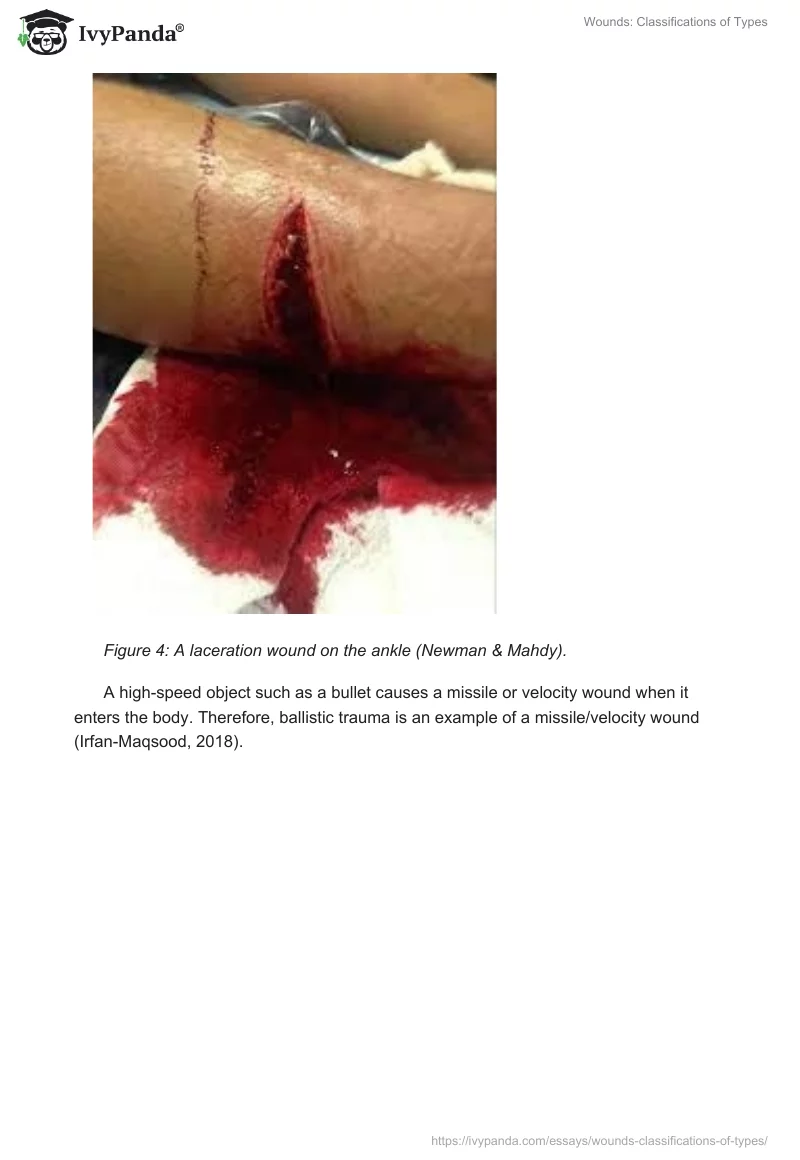 Wounds: Classifications of Types. Page 5