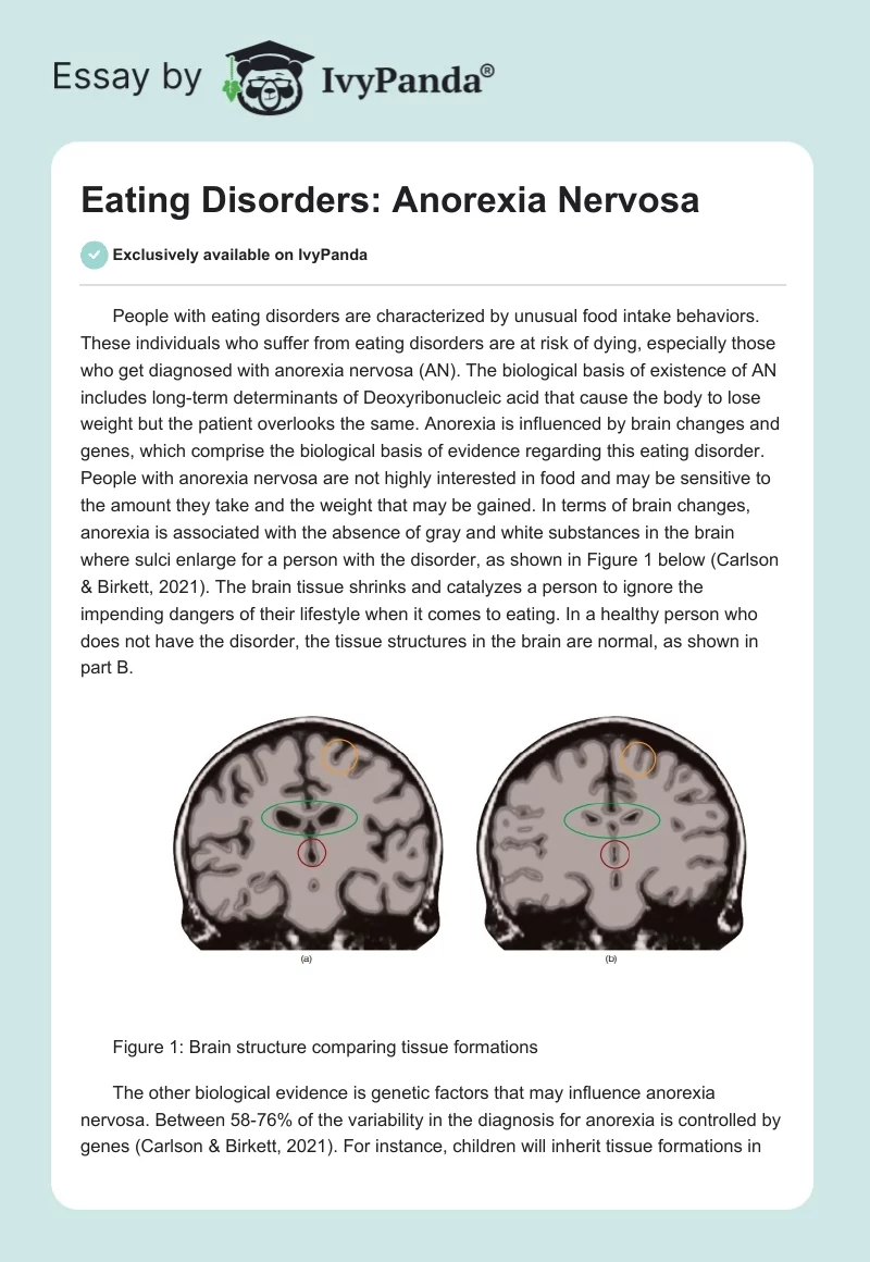 Eating Disorders: Anorexia Nervosa. Page 1