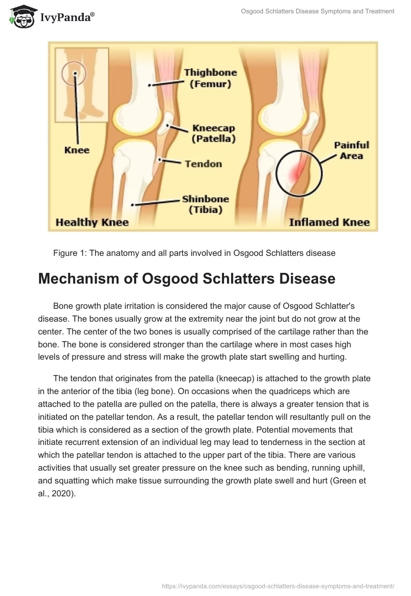 Osgood Schlatters Disease Symptoms and Treatment. Page 2