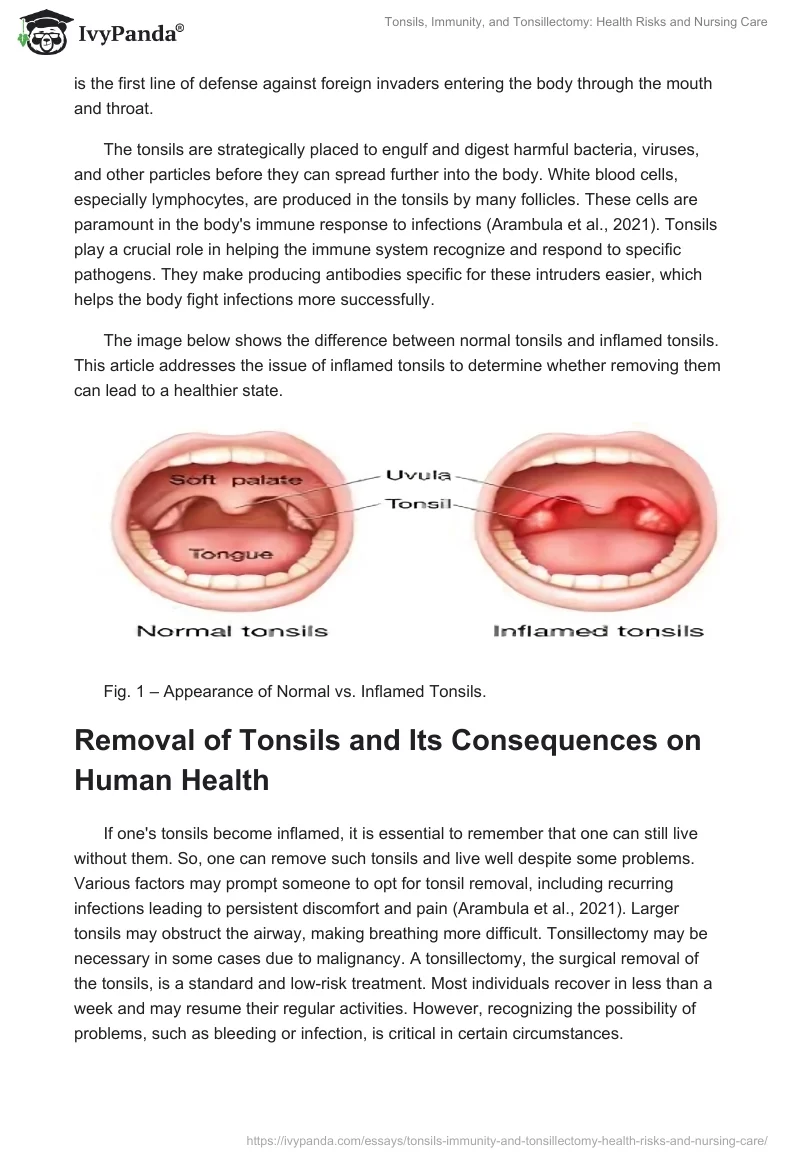 Tonsils, Immunity, and Tonsillectomy: Health Risks and Nursing Care. Page 2