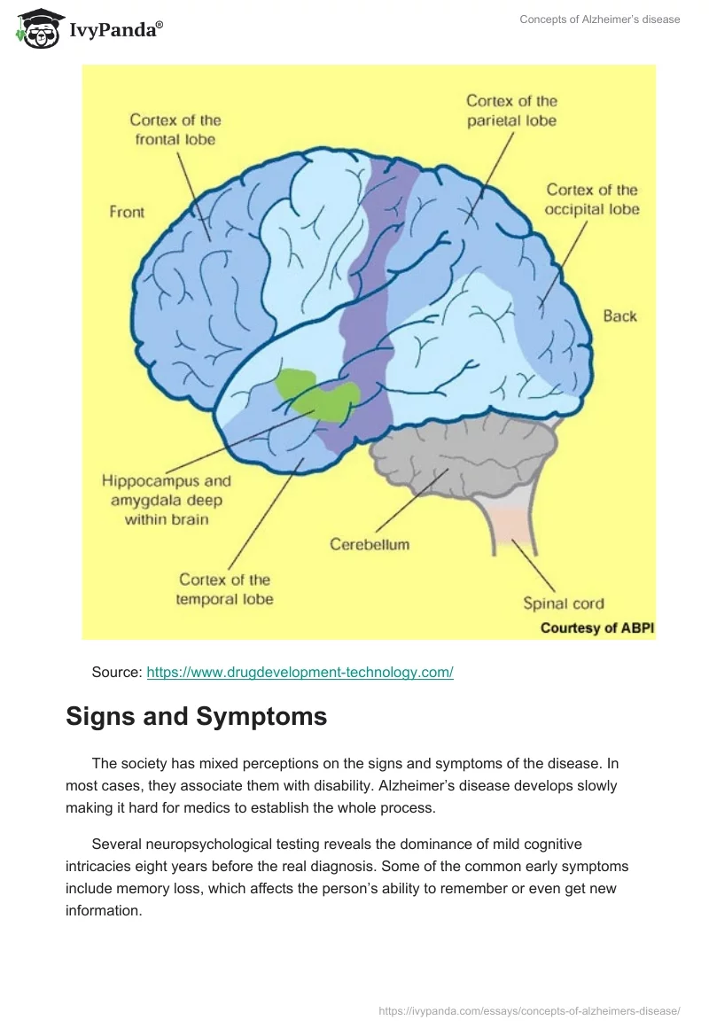 Concepts of Alzheimer’s Disease. Page 4