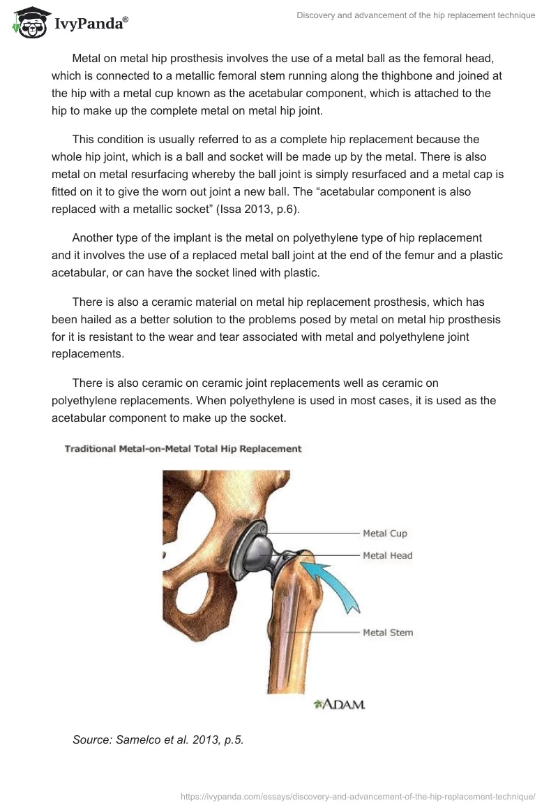 Discovery and advancement of the hip replacement technique. Page 2