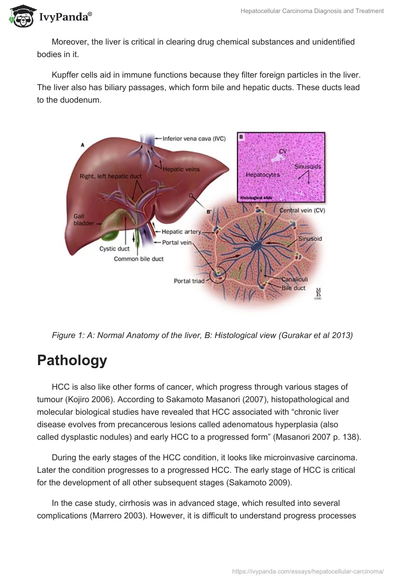 Hepatocellular Carcinoma Diagnosis and Treatment. Page 3
